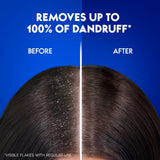 Head & Shoulders Charcoal Detox Anti-Dandruff Shampoo 400 ml - GETIT.QA